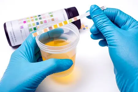 SAP 5-Panel Urine Drug Test