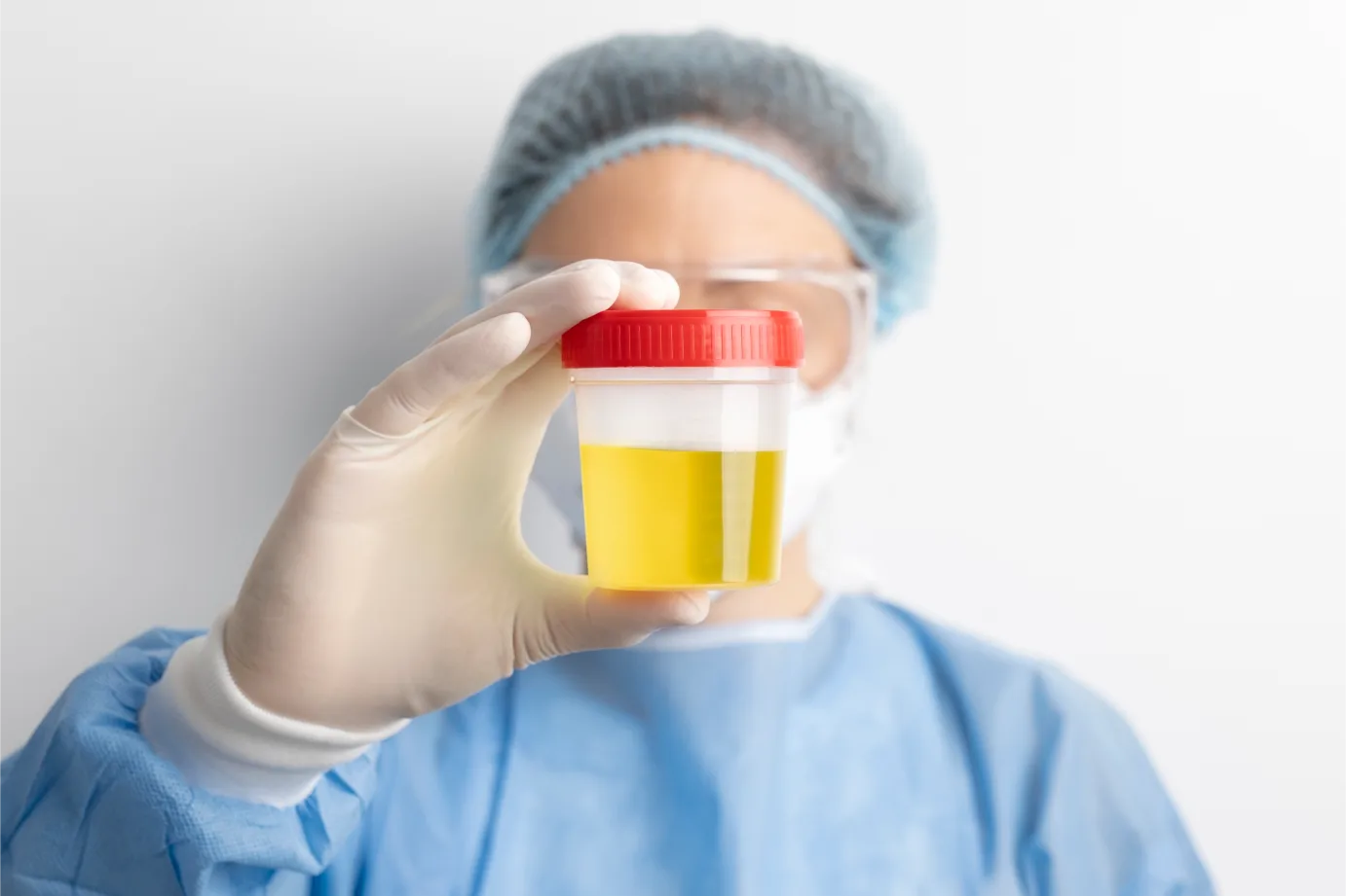 SAP 5-Panel Drug Test (Oxycodone & 6-AM)